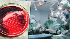 Světem se šíří 12 smrtících bakterií, nedaří se je zastavit!