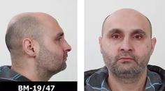 Policie pátrá po ozbrojeném muži! Pobodal servírku a utekl i s penězi