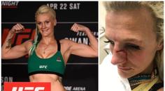 UFC zápasnice se stala obětí domácího násilí. Zmlátil ji expřítel