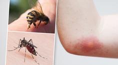 Sezóna štípanců začíná! Poradíme vám, jak se proti nim bránit