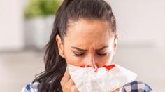 Někteří lidé v létě krvácí z nosu. Experti řekli důvod, varují před zakláněním hlavy