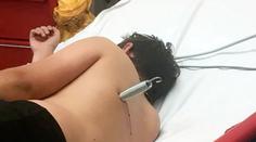 Hra na trampolíně se změnila v horor! Chlapec skončil s pružinou v zádech
