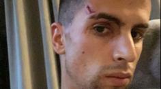 Hvězdný fotbalista Manchesteru byl přepaden u sebe doma, utrpěl i zranění