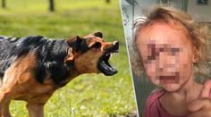 Rozárku (3,5) pokousal pes v obličeji. Z nejhoršího je dívenka venku