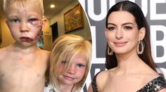 Hrdina (6) uchránil svou sestričku před psem. Celebrity mu vzdaly hold