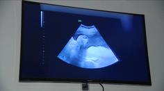 Přes milion žen zanedbává kontroly u gynekologa. Podceňují je hlavně starší ročníky