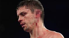 Soupeř rozpůlil Smithovi ucho. Takhle vypadá boxer dnes! FOTO