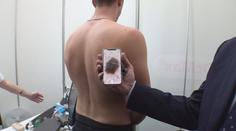 Rychlé a kvalitní vyšetření? Na rakovinu kůže vás může upozornit aplikace