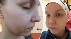Dívka, které teplický lékař zničil zuby, už má nové. A případ řeší komora