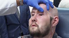 Ojedinělý úspěch amerických lékařů. Provedli první transplantaci celého oka