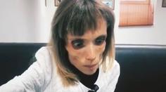 Kristina vypadá jako z hororu. Je kost a kůže, váží jen 17 kilo!