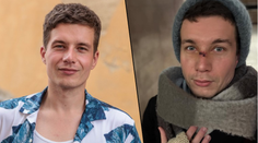 Daniel Krejčík uklouzl na ledu. Ošklivě se zranil v obličeji