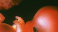 Plody a potraty: Rodiče dostanou šanci pohřbít nenarozené děti