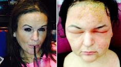 Spálená kůže, hlava jako míč! Tinu (41) skoro zabila barva na vlasy