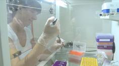 Epidemie žloutenky A stále nepolevuje. Nejhorší je situace v Brně