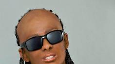 Úžasná proměna: Z Adama Mišíka se stal Stevie Wonder!