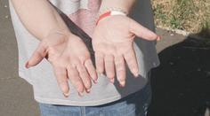 Lékaři varují před akrylovými nehty. Přibývá žen se zdravotními problémy