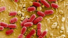 Toho se lékaři obávali: Objevila se bakterie odolná všem antibiotikům