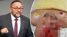 Poslance AfD v Brémách brutálně napadli. Je vážně zraněný
