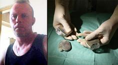 Muž ošálil lékaře, na cizí identitu mu voperovali kardiostimulátor!