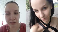 Žena řeší zničené zuby s klinikou, na hororového zubaře podala stížnost