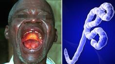 Izolujte Afriku, zavřete hranice, ebola nesmí jít dál, žádá odborník