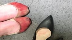 Krvavé nohy po celodenní práci! Komu patří zničená chodidla?