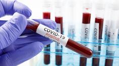 Pět let trvající záhada. WHO konfrontovala Čínu kvůli pandemii covidu