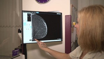 Na preventivní vyšetření rakoviny prsu ženy čekají měsíce. Doba záleží na kraji