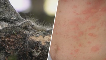 V Berlíně se přemnožily housenky s jedovatými chloupky. Úřady zavřely školy i hřiště