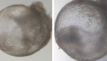 Přelom ve vědě. Výzkumníci vypěstovali první umělé embryo bez spermie i vajíčka