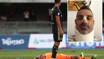 První zářez CR7 v Serii A: Gólman v bezvědomí se zlomeným nosem!