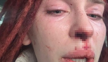 Misska byla obětí brutálního násilí. Přiznal se k tomu známý zpěvák