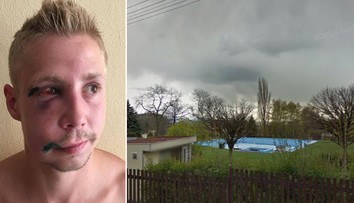 Je to jinak, tvrdí svědkyně o bitce v Dubí: Není to hrdina, praštil ženu