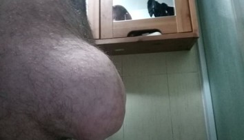 Zoufalého Karla trápí pupeční kýla. Nemocnice ho však nesmí operovat