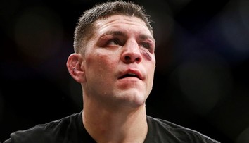 Nick Diaz byl před dopingovou komisí. Výsledek šokoval!