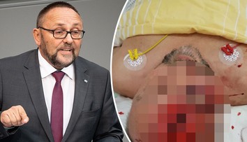 Poslance AfD v Brémách brutálně napadli. Je vážně zraněný