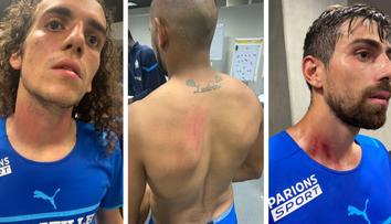 Hráči Marseille po konfliktu s fanoušky: Rány na krku i zádech