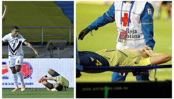 Jen pro otrlé: Schickův spoluhráč utrpěl s reprezentací děsivé zranění