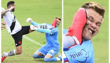 Au, to muselo bolet: Obětavý gólman schytal kopačku přímo do obličeje