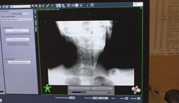 V Česku proběhl den proti rakovině. Počet pacientů roste, lékaři cílí na prevenci