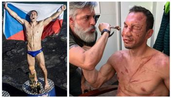 Děsivé šrámy a modřiny. Šampion ve skocích do vody vystrašil fanoušky