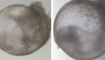 Přelom ve vědě. Výzkumníci vypěstovali první umělé embryo bez spermie i vajíčka