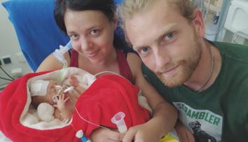 Sofinka prodělala obrnu a potřebuje rehabilitace. Pomáhají Dobří andělé