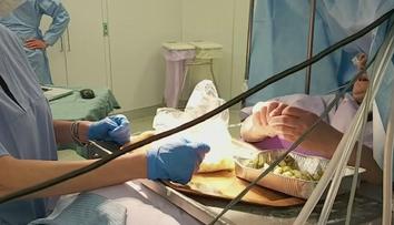 60letá žena z Itálie během skoro tříhodinové operace mozku plnila olivy