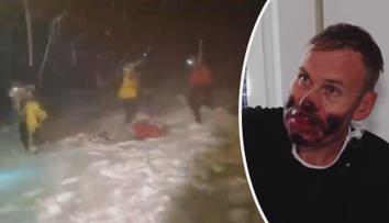 Při výstupu na Elbrus zemřelo pět horolezců. Další ukázali děsivá zranění