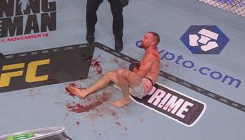 Klein dostal za heroický výkon v UFC finanční bonus! Popsal vážnost zlomeného kotníku