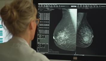 Mamograf snižuje úmrtnost na rakovinu o třetinu. Některé ženy ale vyšetření ignorují