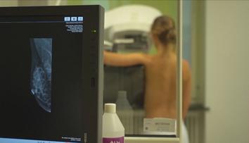Mladí lidé si některá preventivní vyšetření platí sami. Přesto na ně čekají měsíce