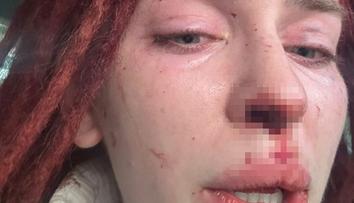 Misska byla obětí brutálního násilí. Přiznal se k tomu známý zpěvák